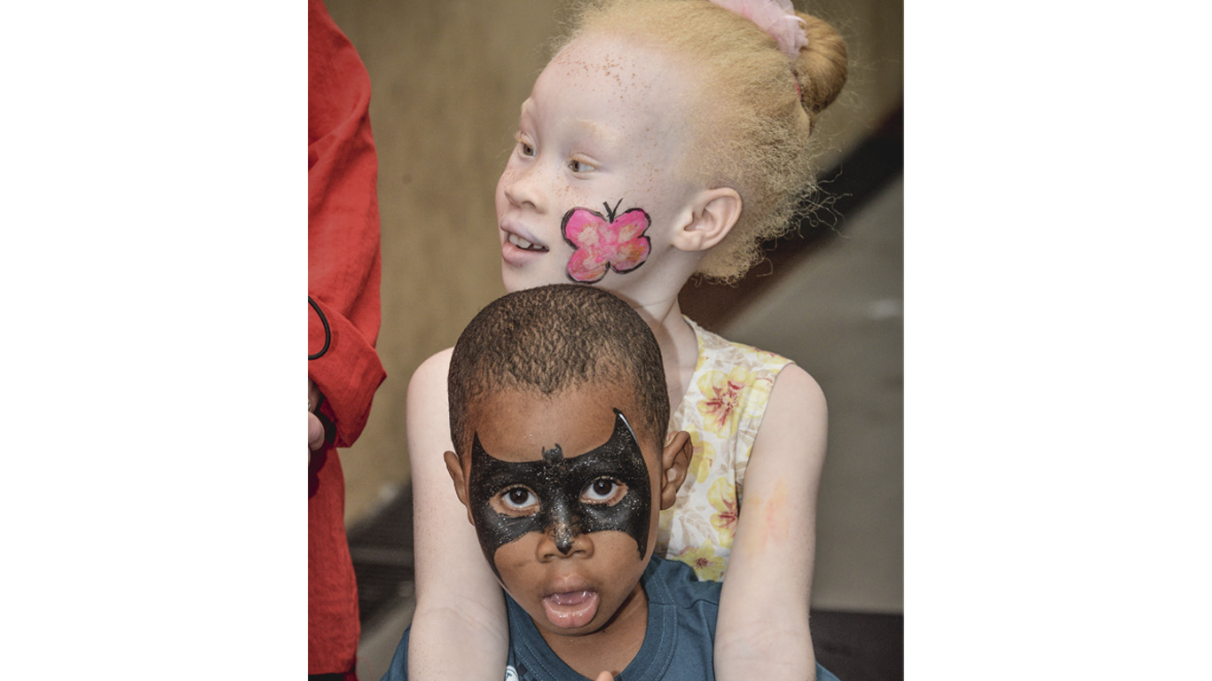 Descrição de imagem: foto de Mônica abraçando o irmão Luciano. Ela é albina, usa vestido amarelo florido e tem uma borboleta pintada na bochecha. O menino é negro, usa camiseta cinza e tem uma máscara do Batman pintada no rosto.